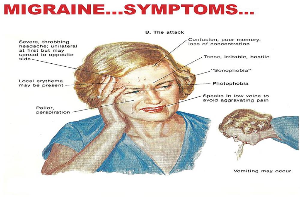 Migraine symptomes